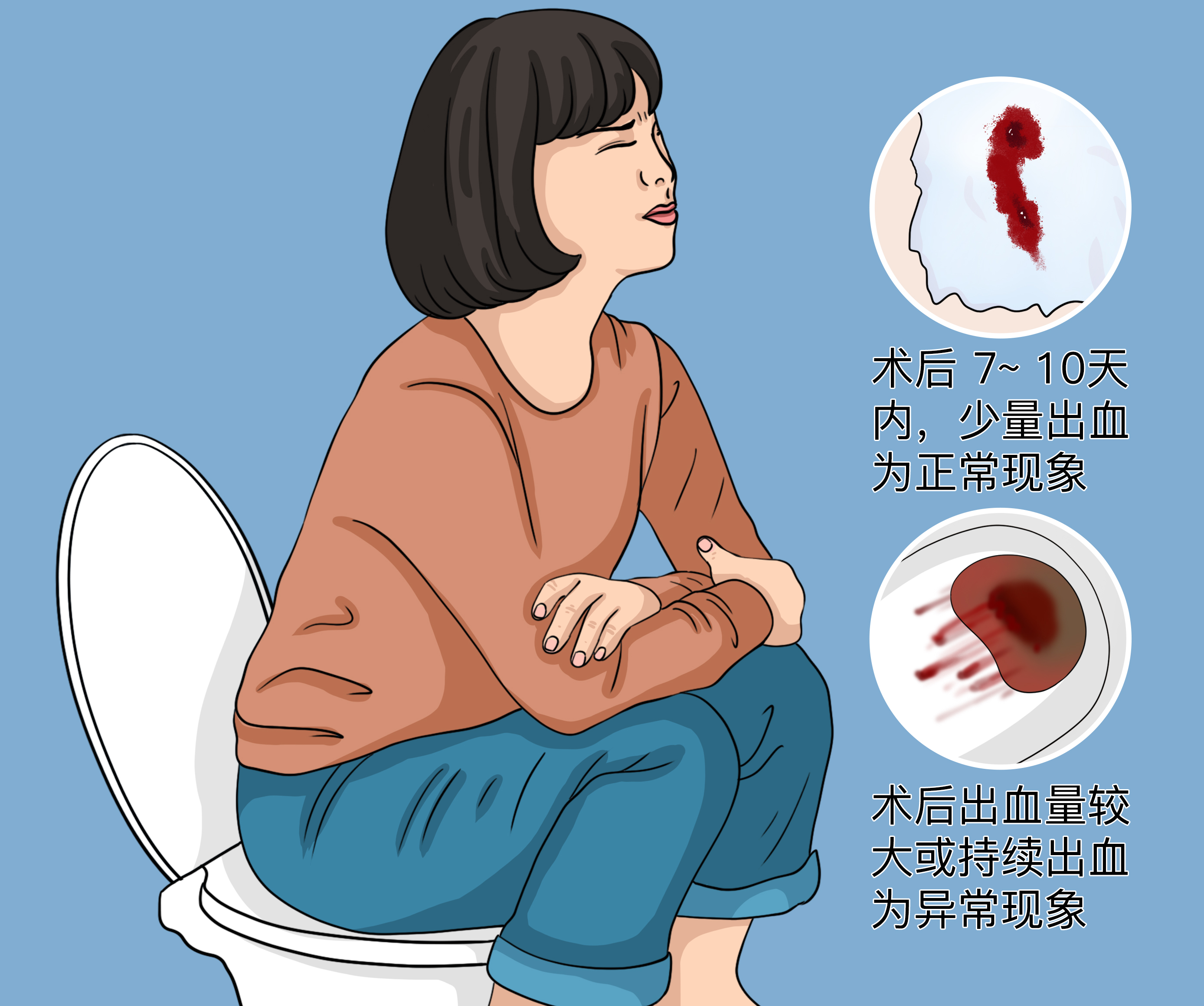 痔疮手术三个月后仍然出血的原因及应对措施